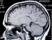 brain x-ray